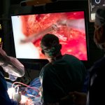 Neurochirurgové sledují operaci mozku na monitoru a ve 3D, Foto ÚVN